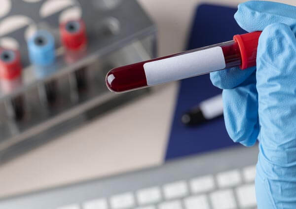 Embrióloga de Clínica Gaia realizando un test de compatiblidad genética