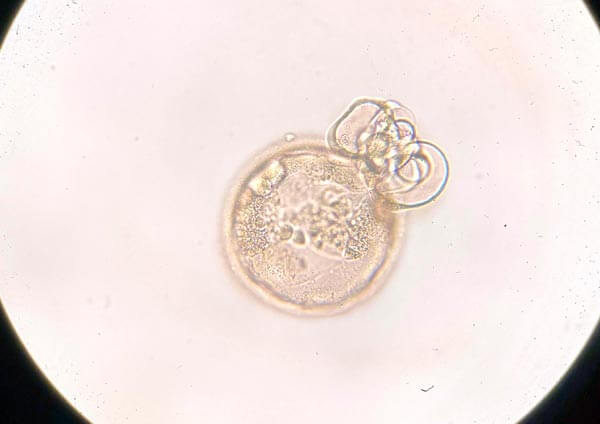 Embrión cultivado en el embryoscope