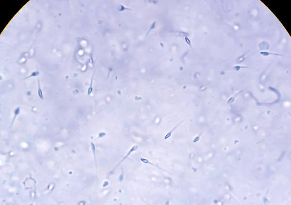 Selección de espermatozoides mediante fertile chip (zymot)