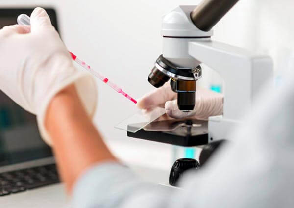 Análisis de biopsia testicular en laboratorio