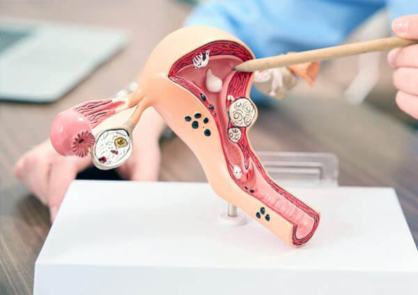 Maqueta del aparato reproductor femenino y la reserva ovárica