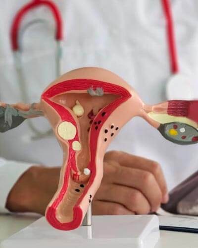 endometriosis-home (1)