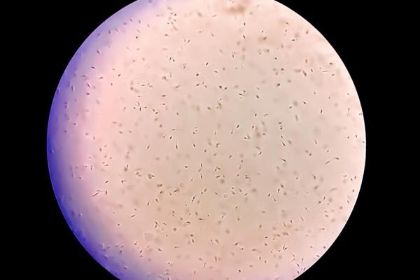 Espermatozoides vistos en el microscopio