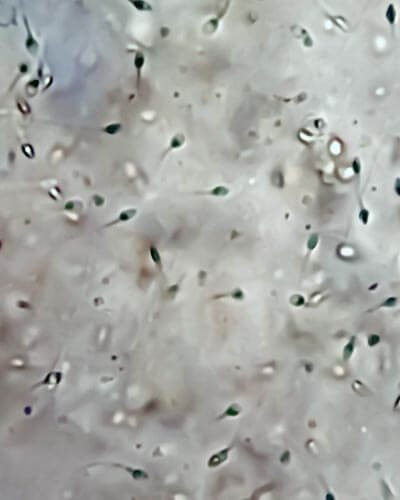 espermatozoides-preservacion (1)