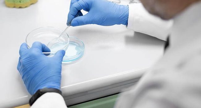 Análisis del factor inmunológico en el laboratorio